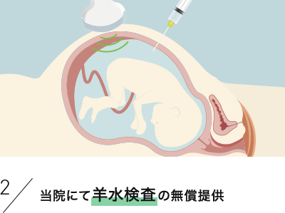 当院にて羊水検査の無償提供