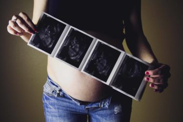 出生前診断に関わる法律とは？人工妊娠中絶に関する日本の実情を解説