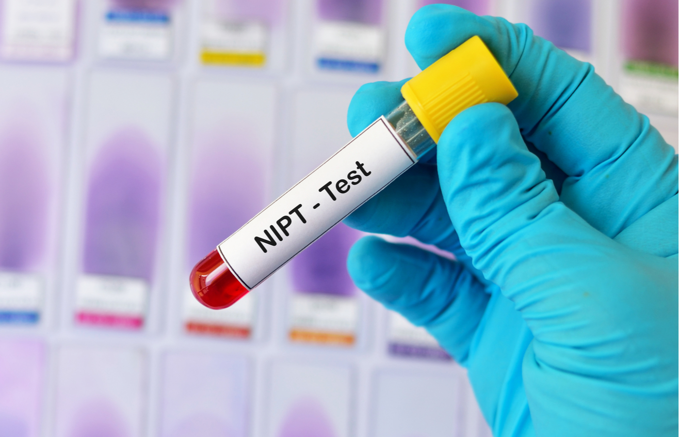 新型出生前診断（NIPT）の受診