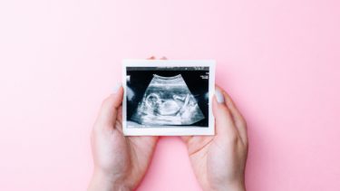 妊婦検診で行う超音波検査とは？検査方法や費用を解説